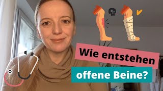 Was sind offene Beine Und wie therapiert man sie FRAG SILKE [upl. by Manwell]