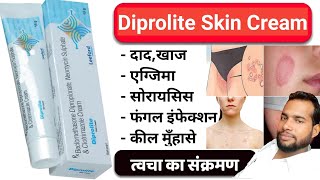 Diprolite Cream  Diprolite Skin Cream uses in hindi  डीप्रोलाइट क्रीम के फायदे [upl. by Areik772]