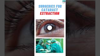 Various surgical procedures for Cataract extractioncataract cataractsurgery cataractsurgeon [upl. by Zavras]