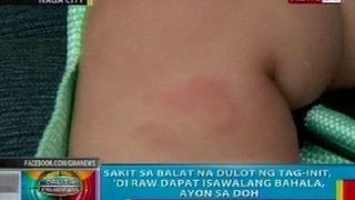 BP Sakit sa balat na dulot ng taginit di dapat isawalang bahala ayon sa DOH [upl. by Saerdna]