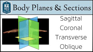 EASY TRICKS for Anatomical Body Planes and Sections DirectionPosition [upl. by Zicarelli]