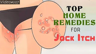 Home remedies for jock itch [upl. by Desmond8]