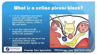 Celiac Plexus Block with a Chicago Pain Management Clinic 847 5194701 [upl. by Wyck]