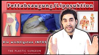 Die wichtigen Infos zur Fettabsaugung Liposuktion  Dr Alawi [upl. by Enelloc]