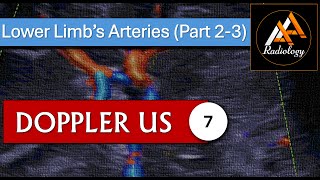 7  Lower Limbs Arteries Part 23 [upl. by Anaud610]