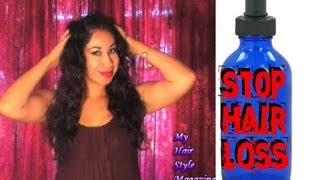 HAIR LOSS TREATMENT for MEN WOMEN natural home remedies Hair Thickening Products for thinning hair [upl. by Ayanat]