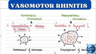 ENT 🔥II VASOMOTOR RHINITIS II RHINITIS MEDICAMENTOSA II NONALLERGIC RHINITIS II EASY EXPLANATION I [upl. by Eibrad]