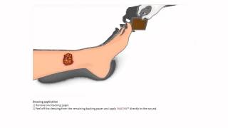 INADINE™ Povidone Iodine NonAdherent Dressing  How to use [upl. by Erastes]