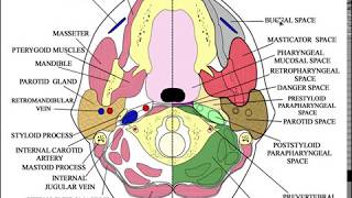 Parapharyngeal fat A Diagnostic clue for neck space lesions [upl. by Parrisch]