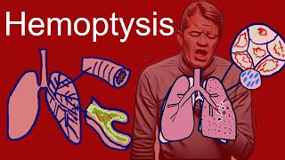 Hemoptysis Coughing Up Blood  Causes types symptoms [upl. by Anier]