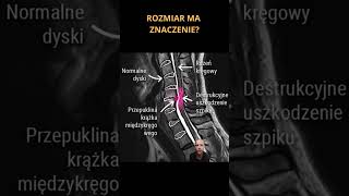 Rozmiar ma znaczenie ból anatomia dyskopatia [upl. by Loginov919]