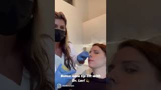 Nose Tip Lift w Botox [upl. by Znerol]