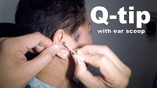 Elderly Womans Ear Cleaning amp Earwax Removal [upl. by Puff230]