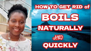 How To Get Rid Of A Boil Naturally And Quickly [upl. by Klingel892]