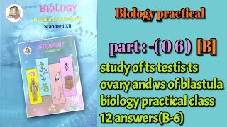 study of ts testis ts ovary and vs of blastula biology practical class 12 answersB6 [upl. by Beatriz439]