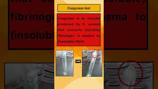 Coagulase test [upl. by Holmen]