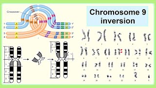 chromosome 9 inversion [upl. by Galvin]