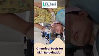 Revitalize Your Glow with Expert Chemical Peels at Public Hospital [upl. by Nere]