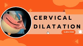 Cervical Dilatation [upl. by Harriet]