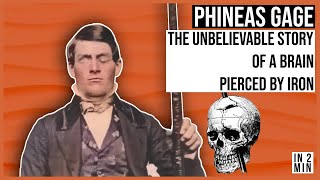 Phineas Gage The Unbelievable Story of a Brain Pierced By Iron [upl. by Rydder]