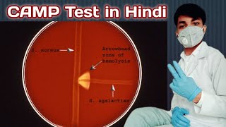 CAMP Test in hindi  CAMP test for streptococcus agalactiae  CAMP Test procedure  Microbiology [upl. by Uohk973]