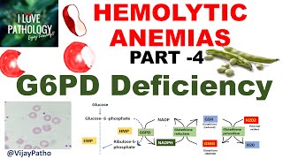 Hemolytic Anemias Part 4 G6PD Deficiency PathophysiologyMorphology clinical features [upl. by Janaye]