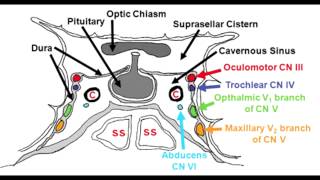 Cavernous Sinus Anatomy amp Cavernous Sinus Syndrome [upl. by Kcirre433]