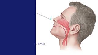 How To Collect A Swab Sample [upl. by Malanie]