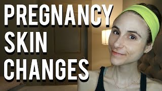 Skin changes during pregnancy Dr Dray 👶 [upl. by Zacks757]