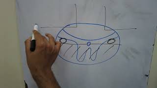 ANTERIOR CORD SYNDROME [upl. by Wrench]