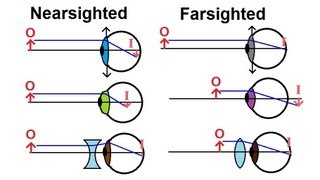 Physics  Optics Vision Correction 1 of 5 Introduction [upl. by Nisaj]