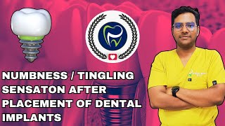 Dr Rudra Mohan  Neurosensory Disturbances After Dental Implant Placement  Numblness  Tingling [upl. by Branscum]