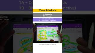 Xerophthalmia  Vitamin A deficiency tcml shorts shortsyoutube [upl. by Holton413]