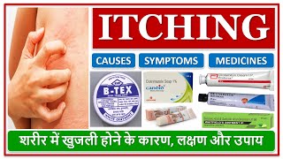 ITCHING शरीर में खुजली होने के कारण लक्षण और उपाय CAUSES SYMPTOMS MEDICINES FOR ITCHING ON SKIN [upl. by Shena]