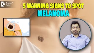 5 Warning Signs of MelanomaMelanoma amp Skin Cancer Awareness MonthDrRajdeep MysoreDoctors Circle [upl. by Lowndes]