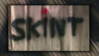 Skint s01e06 [upl. by Aohsoj]