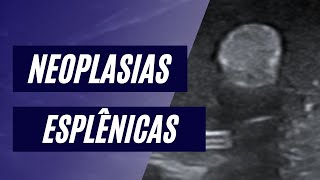 Neoplasias esplênicas [upl. by Ternan]