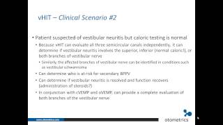 ICS Impulse vHIT Clinical applications [upl. by Burrows]