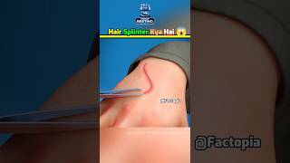 Remove Hair Splinter Immediately ⚠️ shorts fact splinter [upl. by Gardol869]