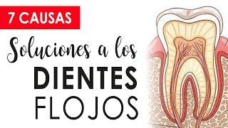 CUIDADO CON LOS DIENTES FLOJOS  CAUSAS Y SOLUCIONES 😱 [upl. by Glenine]