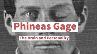 Phineas Gage a case study [upl. by Noiram]