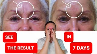 Antiaging Face Massage Techniques To Reduce Forehead wrinklesDouble Chin and Sagging Cheeks [upl. by Smitty909]