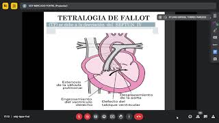 Cardiopatías congénitas cianóticas Dr m2024 01 25 [upl. by Tocs265]