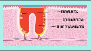 PROCESO DE CICATRIZACIÓN EN EXTRACCIÓN DENTAL [upl. by Neetsirk527]