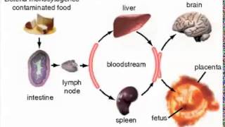 Listeria monocytogenes grampositive rod one cause of meningitis [upl. by Tonnie673]