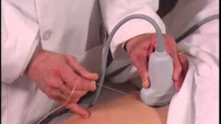 Ultrasound Guided Hip Injection SonoSite [upl. by Ettelegna989]