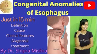 Congenital Anomalies Of Esophagus part1  Tracheoesophageal Fistula Dr Shipra Mishra [upl. by Ahsimed909]