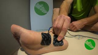 Electrostimulation du pied [upl. by Kohcztiy]