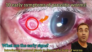 10 early symptoms of parasitic Worms cestodes  5 natural plants to clean the body of worms [upl. by Kilar]