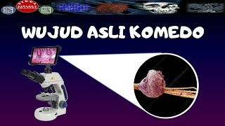 ZOOM KOMEDO DENGAN MIKROSKOP ELEKTRONBLACKHEADS UNDER MICROSCOPE  DIRGA BIOLOGY CHANNEL [upl. by Novar237]